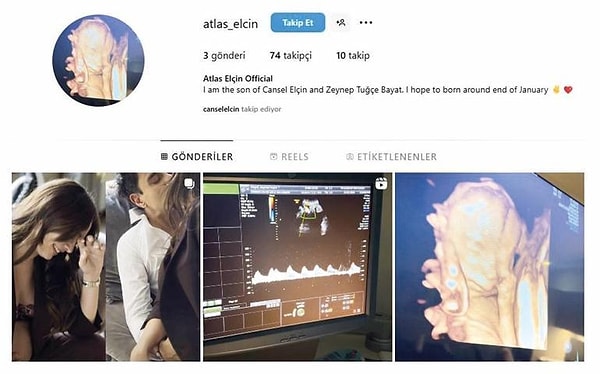 cocuguna sosyal medya hesabi acan unluler kervanina cansel elcin ve zeynep tugce bayat cifti AX3NDB8q