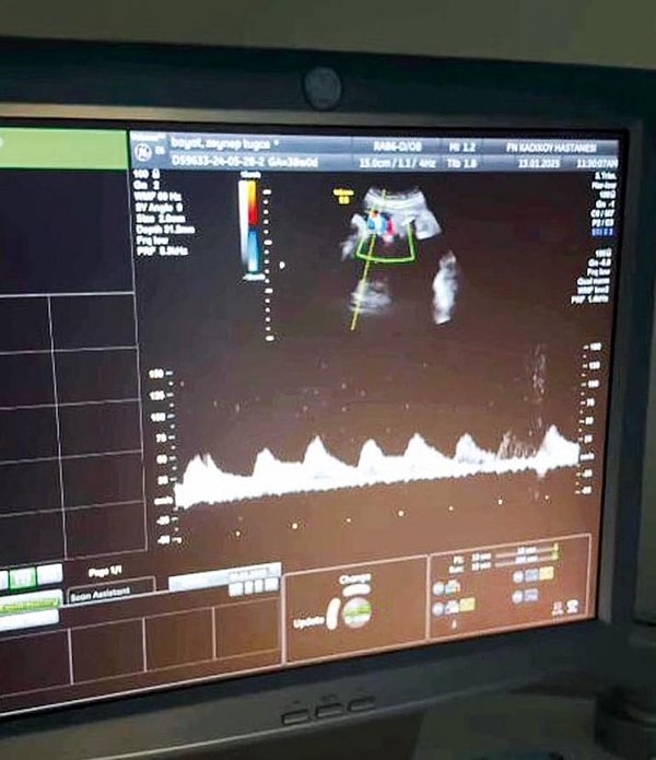 cocuguna sosyal medya hesabi acan unluler kervanina cansel elcin ve zeynep tugce bayat cifti r6AtbKZR