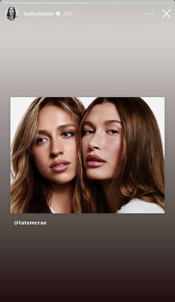 jennerin kopeginden ders calisan madonnaya 25 ocakta yabanci unlulerin instagram paylasimlari 5 iVyGXzuB