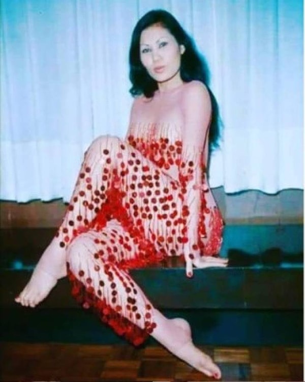 yuzune yemeklik yag enjekte edildigi icin hayati cehenneme donen oyuncunun son hali sasirtti 3 muUAv9WV