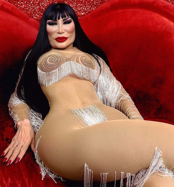 yuzune yemeklik yag enjekte edildigi icin hayati cehenneme donen oyuncunun son hali sasirtti 7