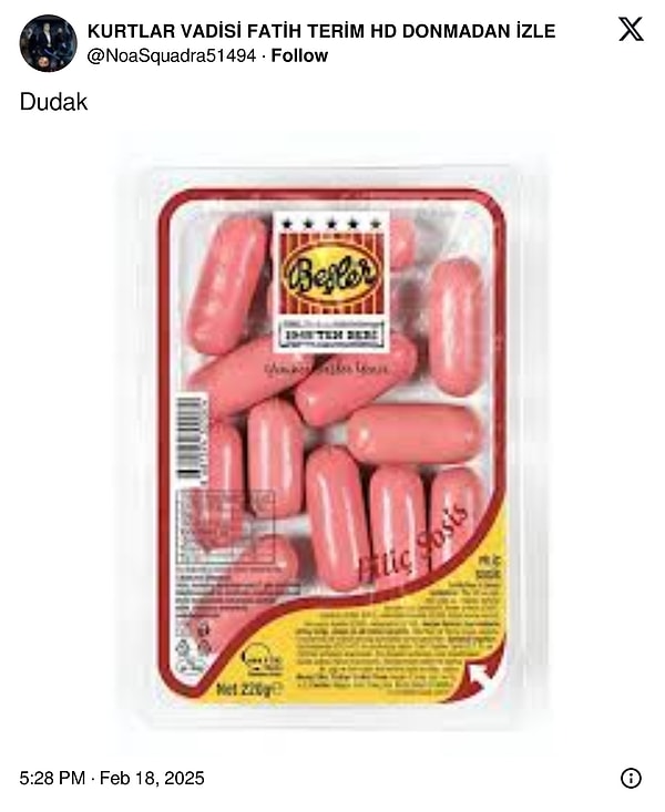 32 Ameliyat Sonrası 'Dünyanın En Büyük Dudaklı Kadını' Olan Andrea Ivanova X'te Goygoyseverlere Malzeme Oldu! 10 32 ameliyat sonrasi dunyanin en buyuk dudakli kadini olan andrea ivanova xte goygoyseverlere malzeme cJm71clE