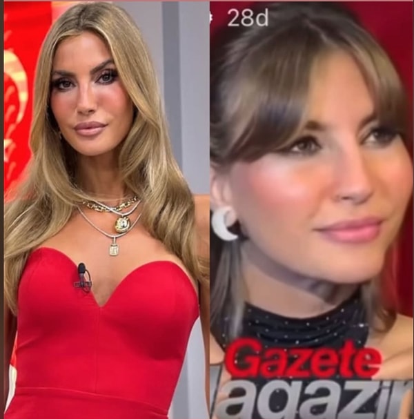 Dudaklarındaki İşlem Olay Olmuştu: Çağla Şıkel'in Yanaklarına Yaptırdığı Dolgu Miktarı Görenleri Şoke Etti! 7 dudaklarindaki islem olay olmustu cagla sikelin yanaklarina yaptirdigi dolgu miktari gorenleri soke etti 6 mS64aRck