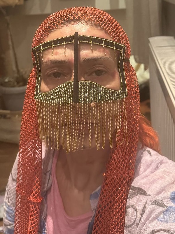 Saç Boyası Nedeniyle Yüzünde Yanıklar Oluşan Yıldız Tilbe, Taktığı Taşlı Maske ile Dikkatleri Üzerine Çekti 4 sac boyasi nedeniyle yuzunde yaniklar olusan yildiz tilbe taktigi tasli maske ile dikkatleri uzerine zTW9g8ym