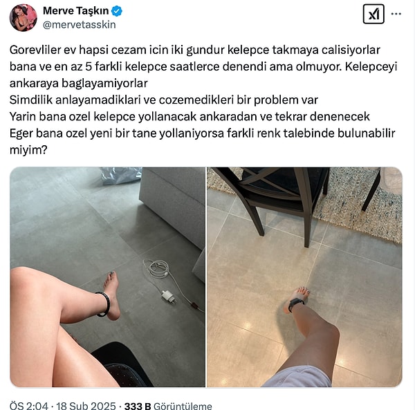 Sevgililer Günü Teklifi Sonrası Ev Hapsi Verilen Merve Taşkın Kelepçenin Takılamamasından Dert Yandı 6 sevgililer gunu teklifi sonrasi ev hapsi verilen merve taskin kelepcenin takilamamasindan dert yandi 5 szVWWMHD