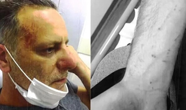 Sevgilisi Deniz Bulutsuz'u Darp Ettiği İddiasıyla Yargılanan Ozan Güven Mütalaadan Sonra İlk Kez Konuştu! 4 sevgilisi deniz bulutsuzu darp ettigi iddiasiyla yargilanan ozan guven mutalaadan sonra ilk kez konustu H2XPbntf