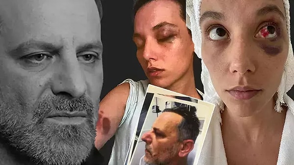 Sevgilisi Deniz Bulutsuz'u Darp Ettiği İddiasıyla Yargılanan Ozan Güven Mütalaadan Sonra İlk Kez Konuştu! 3 sevgilisi deniz bulutsuzu darp ettigi iddiasiyla yargilanan ozan guven mutalaadan sonra ilk kez konustu dOEpzTgq