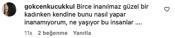 Yeni İmajı Herkese Dert Oldu: Saçlarını Kestiren Birce Akalay'ın Edis ve Yılmaz Morgül'e Tuhaf Benzerliği! 11 yeni imaji herkese dert oldu saclarini kestiren birce akalayin edis ve yilmaz morgule tuhaf 5Mm7pUOk