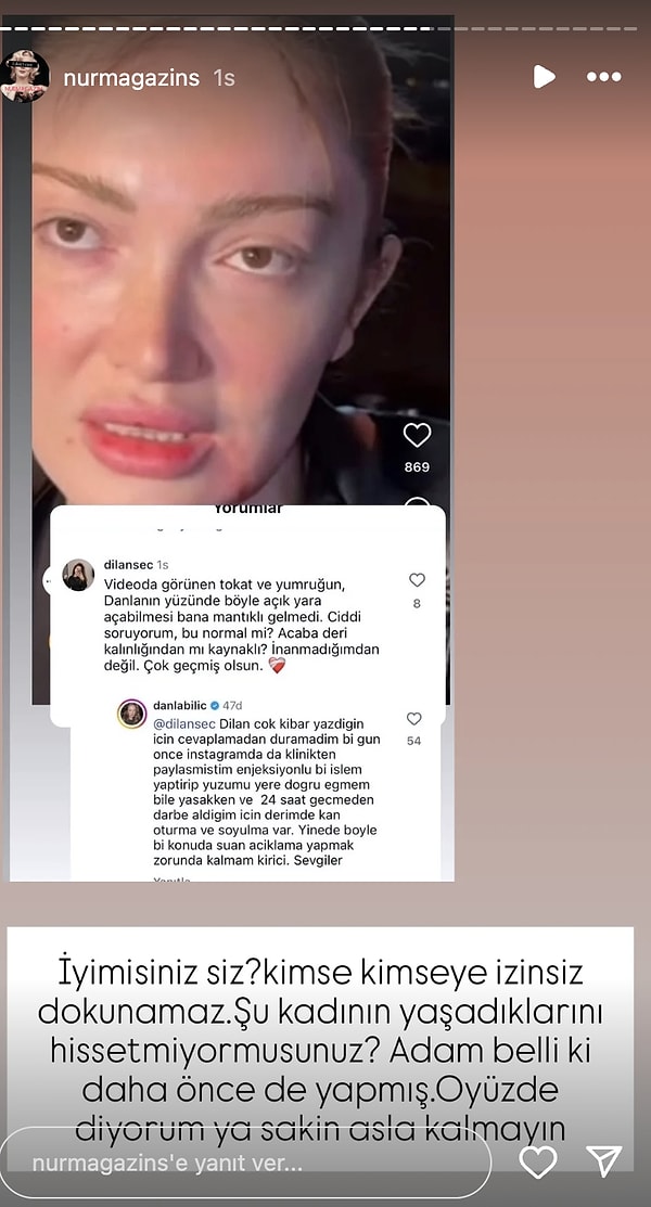 Danla Bilic Yara İzini Sorgulayan Kullanıcıya Cevap Verdi 2 danla bilic yara izini sorgulayan kullaniciya cevap verdi 1