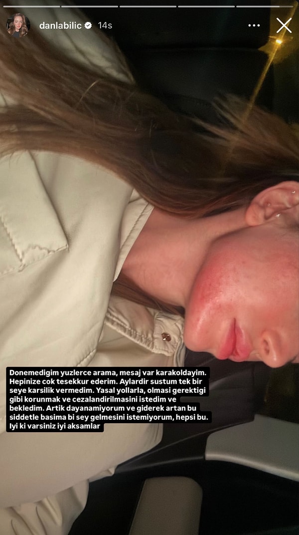 Eski Sevgilisi Berk Çetin Tarafından Darp Edildiğini Söyleyen Danla Bilic Yüzünün Halini Paylaştı 4 eski sevgilisi berk cetin tarafindan darp edildigini soyleyen danla bilic yuzunun halini paylasti 3 GAk8lfDj