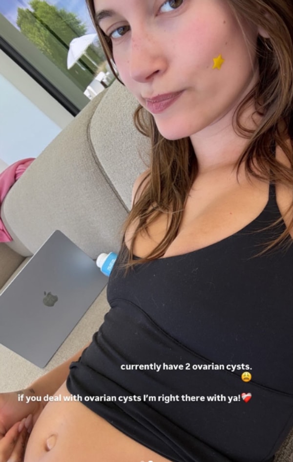 Justin Bieber ile Yaşadığı Aşkla Toksik İlişkinin Kitabını Yazan Hailey Bieber'dan Üzen Hastalık Paylaşımı 3 justin bieber ile yasadigi askla toksik iliskinin kitabini yazan hailey bieberdan uzen hastalik paylasimi 6Fi9yFKi