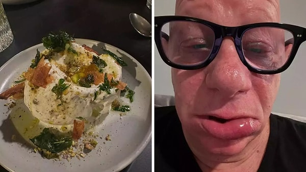 Yediği Dondurma Bu Hale Getirdi: Ünlü Komedyen Jeff Ross Hastanelik Oldu, Son Durumunu Paylaştı 2 yedigi dondurma bu hale getirdi unlu komedyen jeff ross hastanelik oldu son durumunu paylasti bQlZ91yS
