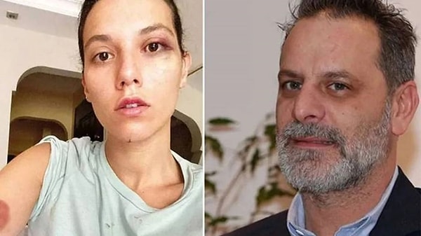 Böyle Arkadaş Herkesin Başına! Ozan Güven'e Doğum Gününde Beşibiryerde Hediye Edildi 1 boyle arkadas herkesin basina ozan guvene dogum gununde besibiryerde hediye edildi 0 nIl3ZicO