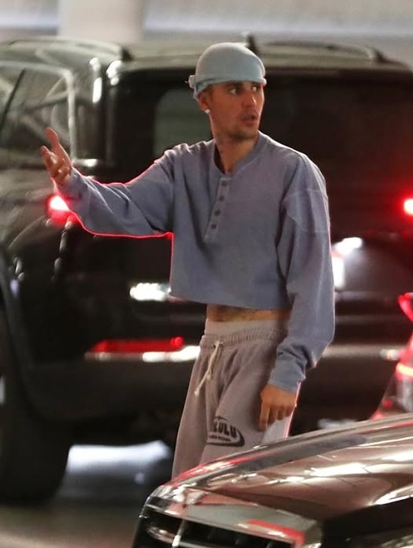 Eski Halinden Eser Kalmadığı Gibi Her Gördüğümüzde Ayrı Çöken Justin Bieber 31 Yaşında Kel Kaldı! 2 eski halinden eser kalmadigi gibi her gordugumuzde ayri coken justin bieber 31 yasinda kel GeIsFHvc