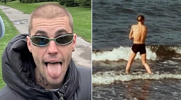 Eski Halinden Eser Kalmadığı Gibi Her Gördüğümüzde Ayrı Çöken Justin Bieber 31 Yaşında Kel Kaldı! 3 eski halinden eser kalmadigi gibi her gordugumuzde ayri coken justin bieber 31 yasinda kel Nkg1DrR9