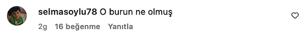 Estetiğin Dozu Kaçmış: Eski Partneri Cengiz Semercioğlu'na Konuk Olan Seren Serengil'in Son Hali Şoka Soktu! 8 estetigin dozu kacmis eski partneri cengiz semerciogluna konuk olan seren serengilin son hali soka EUN9Acta