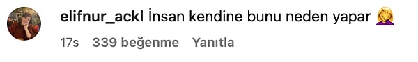 Estetikten Geri Kalmamış: Sinan Akçıl'ın Botoks ve Dolgularla Şişen Yüzünün Son Hali Dillere Fena Düştü! 9 estetikten geri kalmamis sinan akcilin botoks ve dolgularla sisen yuzunun son hali dillere fena dSAAWWtY