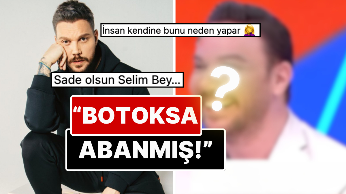 estetikten geri kalmamis sinan akcilin botoks ve dolgularla sisen yuzunun son hali dillere fena