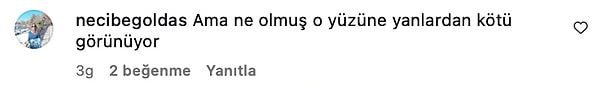 gokselle ayni doktora mi gidiyorlar cagla sikelin dozu kacmis dolgulariyla verdigi poz bu kim 92l4slKc