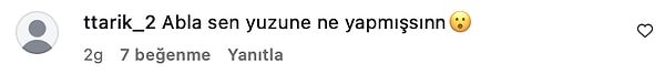 gokselle ayni doktora mi gidiyorlar cagla sikelin dozu kacmis dolgulariyla verdigi poz bu kim KMuKnK63