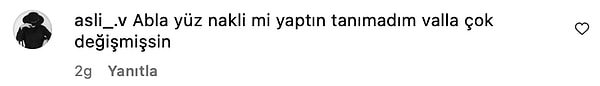 gokselle ayni doktora mi gidiyorlar cagla sikelin dozu kacmis dolgulariyla verdigi poz bu kim abihyly4