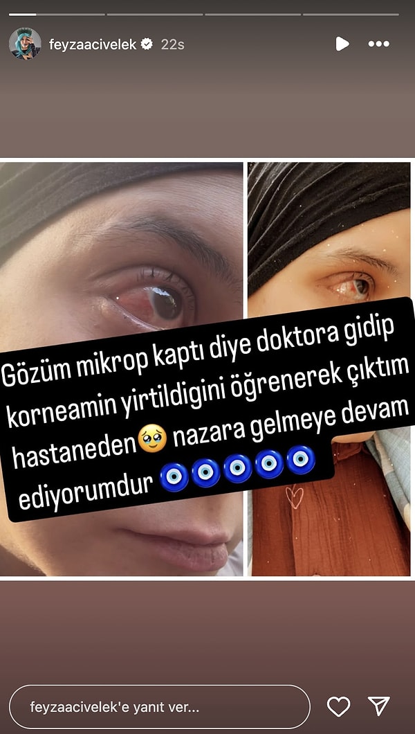 Kızılcık Şerbeti'nin Nilay'ı Feyza Civelek Hastanelik Oldu: Paylaşımıyla Gözünün Son Halini Paylaştı! 3 kizilcik serbetinin nilayi feyza civelek hastanelik oldu paylasimiyla gozunun son halini paylasti 2 bOzIP65O
