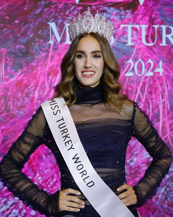 sabaniyeye benzetilen ve derecesi sorgulanan miss turkey guzeli idil bilgenden gercek guzellik tarifi 0 nKp5NnjQ
