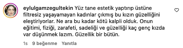 sabaniyeye benzetilen ve derecesi sorgulanan miss turkey guzeli idil bilgenden gercek guzellik tarifi 8 CHB1Cr3k