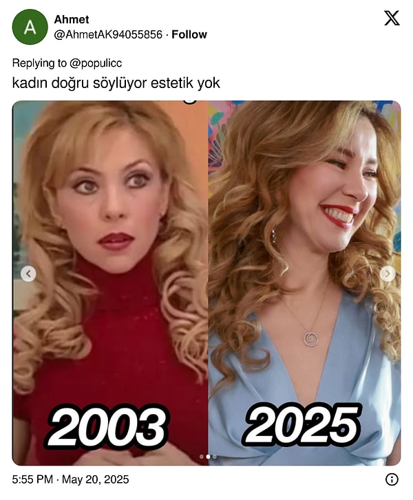 Sihirli Annem'in Betüş'ü İnci Türkay'ın Estetik Yaptırmadığını Kanıtlama Çabası X'te Dillere Fena Düştü 9 sihirli annemin betusu inci turkayin estetik yaptirmadigini kanitlama cabasi xte dillere fena dustu 8 eZEUsEkJ