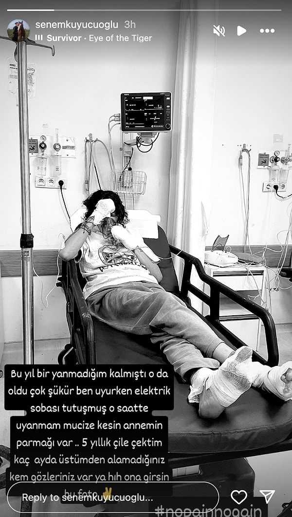 Uyurken Elleri ve Ayakları Yanmış: Eski Türkiye Güzeli Senem Kuyucuoğlu Hastanelik Oldu! 3 uyurken elleri ve ayaklari yanmis eski turkiye guzeli senem kuyucuoglu hastanelik oldu 2