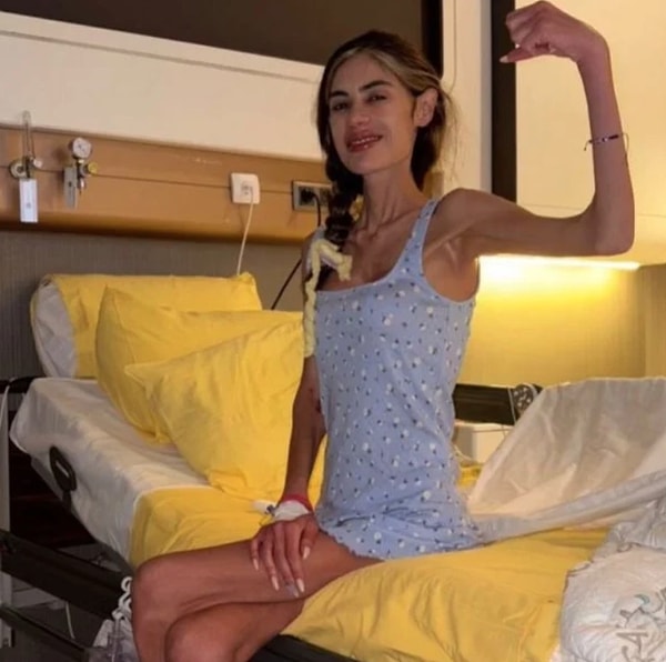 cagimizin en buyuk saglik sorunlarindan biri anoreksiya nervoza hastaligi ile savasan unlu isimler 1