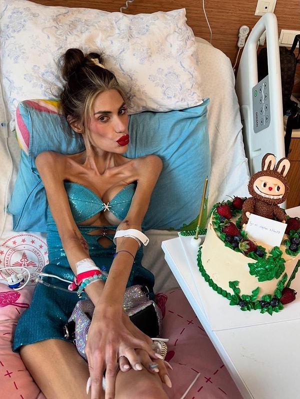 Kalbi Yine Dayanamadı: Yoğun Bakımda Mamayla Beslenen Nihal Candan'ın Babasından İkinci Kez Kötü Haber! 1 kalbi yine dayanamadi yogun bakimda mamayla beslenen nihal candanin babasindan ikinci kez kotu haber RVPKcIe7