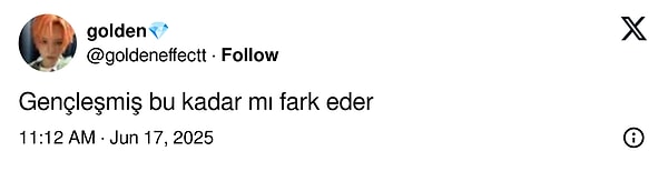 resmen genclesti sakallarini kesince yuzu gozu acilan burak ozcivitin son hali buyuk begeni topladi G5FGvG2E