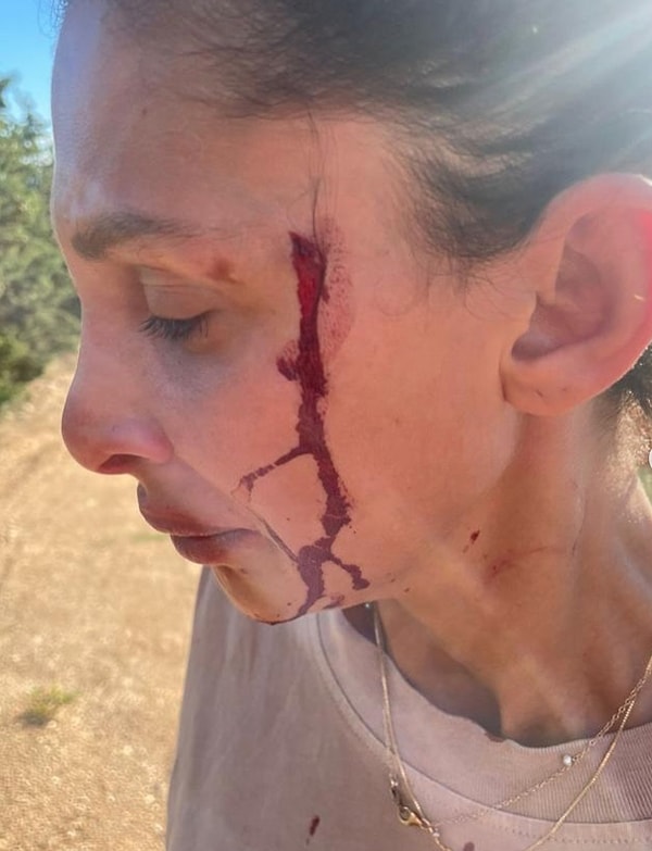 Can Yaman'ın Yeni Sevgilisi Sara Bluma Çocuğunun Babasından Şiddet Gördüğünü Açıkladı 3 can yamanin yeni sevgilisi sara bluma cocugunun babasindan siddet gordugunu acikladi 2 uVvHHrud