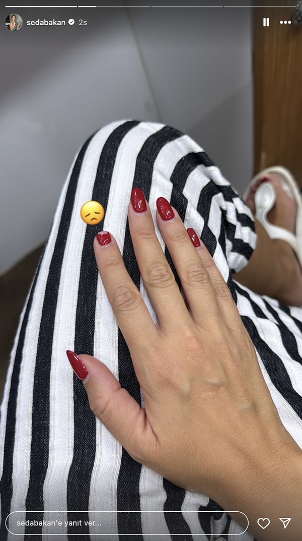 seyma subasi basini bagladi didem soydan liseli halini paylasti 22 temmuzda unlulerin instagram hikayeleri hE8jRPAO