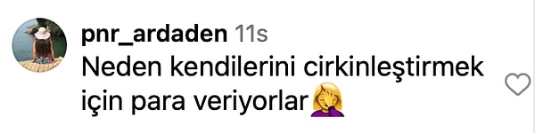 Estetik Kervanına Katıldı: Güzelliğiyle Büyüleyen Esra Bilgiç’in Estetikli Yüzü Doğal Haliyle Karşılaştırıldı! 14 estetik kervanina katildi guzelligiyle buyuleyen esra bilgicin estetikli yuzu dogal haliyle karsilastirildi 13 kksNjwma