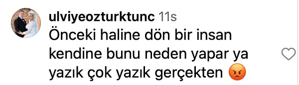 Estetik Kervanına Katıldı: Güzelliğiyle Büyüleyen Esra Bilgiç’in Estetikli Yüzü Doğal Haliyle Karşılaştırıldı! 15 estetik kervanina katildi guzelligiyle buyuleyen esra bilgicin estetikli yuzu dogal haliyle karsilastirildi 14 h5CyNOfu