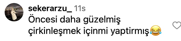 Estetik Kervanına Katıldı: Güzelliğiyle Büyüleyen Esra Bilgiç’in Estetikli Yüzü Doğal Haliyle Karşılaştırıldı! 16 estetik kervanina katildi guzelligiyle buyuleyen esra bilgicin estetikli yuzu dogal haliyle karsilastirildi 15 FnmwJKzm