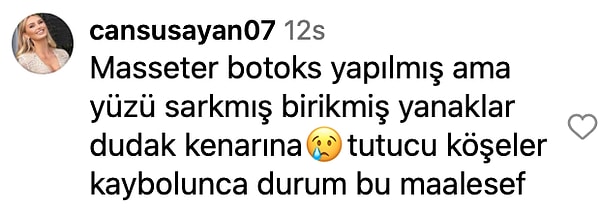 Estetik Kervanına Katıldı: Güzelliğiyle Büyüleyen Esra Bilgiç’in Estetikli Yüzü Doğal Haliyle Karşılaştırıldı! 8 estetik kervanina katildi guzelligiyle buyuleyen esra bilgicin estetikli yuzu dogal haliyle karsilastirildi 7 kkJ7Oilt