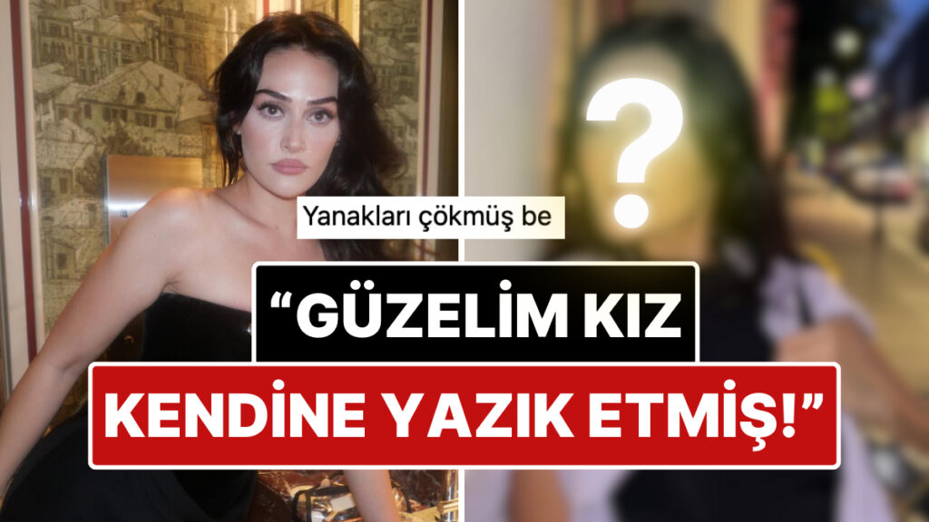 estetik kervanina katildi guzelligiyle buyuleyen esra bilgicin estetikli yuzu dogal haliyle karsilastirildi ONxv63vc