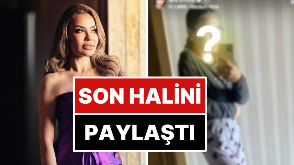 Beyninde Kitle Tespit Edildiğini Açıklayan Şarkıcı Lara, Son Halini Paylaştı 7 beyninde kitle tespit edildigini aciklayan sarkici lara son halini paylasti tUzqXaVO