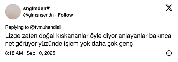 carpintinin yildizi lizge comertin cocukluk fotografi estetik iddialarini yikti gecti 11