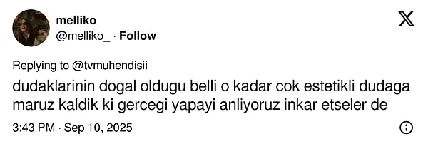 carpintinin yildizi lizge comertin cocukluk fotografi estetik iddialarini yikti gecti 13 EuFj2p9V