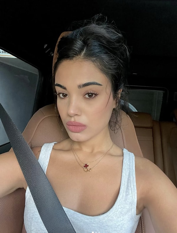 carpintinin yildizi lizge comertin cocukluk fotografi estetik iddialarini yikti gecti 2 nIU3D7ED