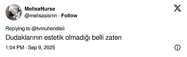 carpintinin yildizi lizge comertin cocukluk fotografi estetik iddialarini yikti gecti 8 HryNPq3d