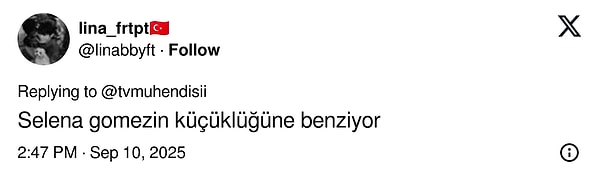 carpintinin yildizi lizge comertin cocukluk fotografi estetik iddialarini yikti gecti 9 qw8jpHO3