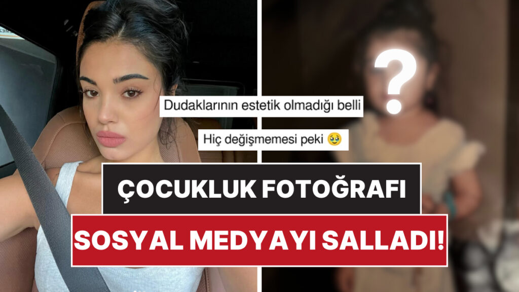 carpintinin yildizi lizge comertin cocukluk fotografi estetik iddialarini yikti gecti awZzcDkW