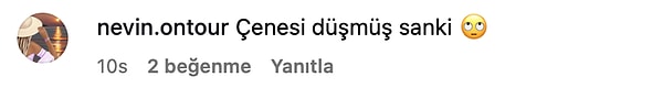 cenesi goze batti yaptirdigi estetik islemlerle gundem olan yilmaz morgulun yuzunun son hali dile LI9hjsa1