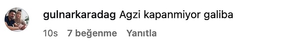 cenesi goze batti yaptirdigi estetik islemlerle gundem olan yilmaz morgulun yuzunun son hali dile eGFrqKFM