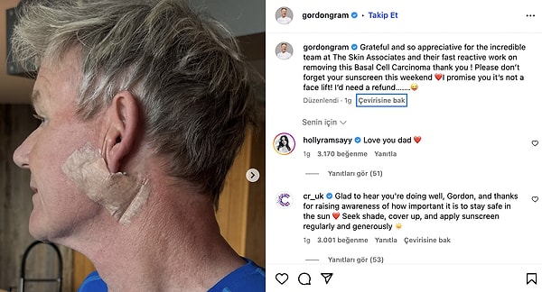 Dünyaca Ünlü Şef Gordon Ramsay'den Sevenlerini Üzen Haber: Kansere Yakalandığını Duyurdu! 1 dunyaca unlu sef gordon ramsayden sevenlerini uzen haber kansere yakalandigini duyurdu 0 6XLTsAcN